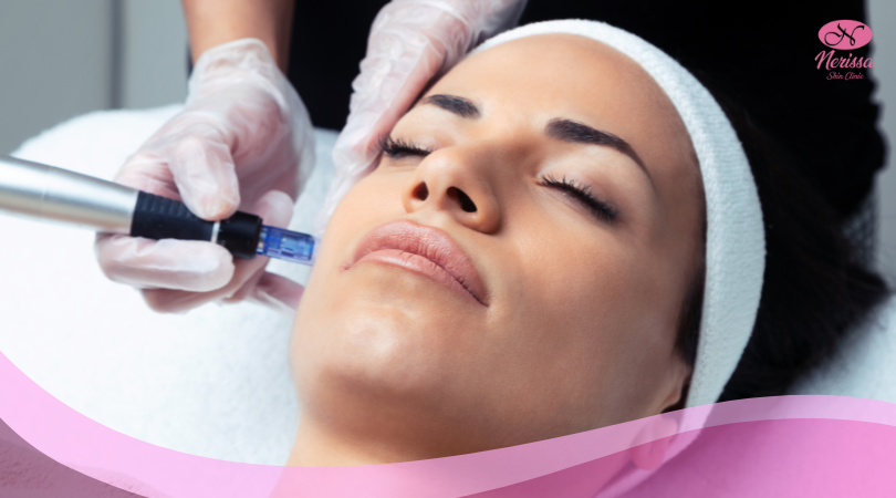 mts-exosome-by-nerissa-skin-clinic-purwodadi-grobogan