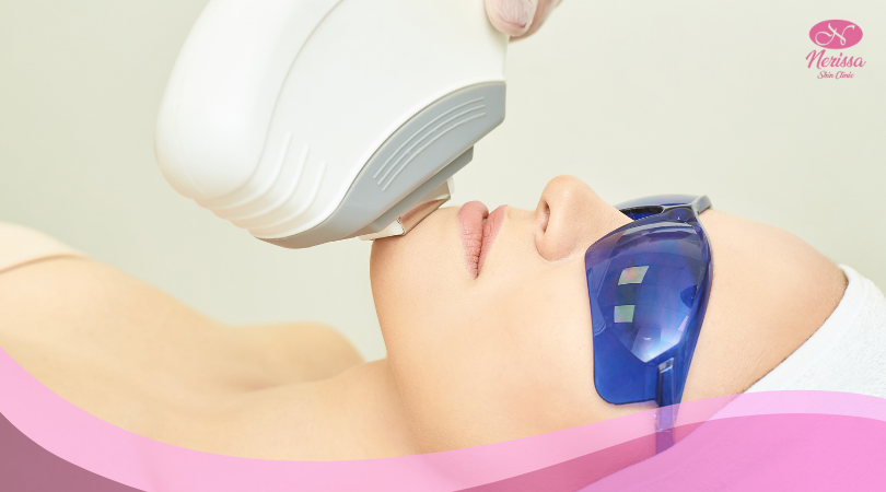 laser-ipl-express-glowing-by-nerissa-skin-clinic-purwodadi-1