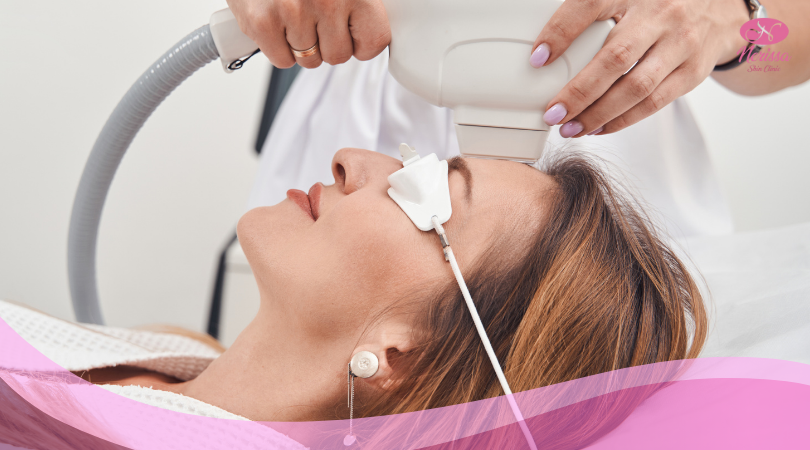 laser-ipl-instant-glowing-by-nerissa-skin-clinic-purwodadi-1