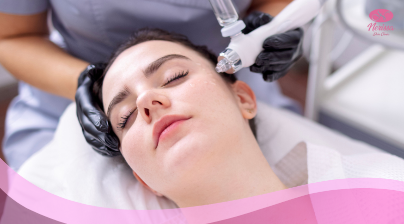 facial-oxy-spray-by-nerissa-skin-clinic-purwodadi