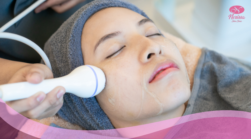 facial-rf-radio-frequency-by-nerissa-skin-clinic-purwodadi