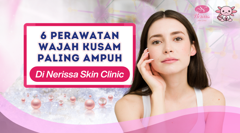 6-rekomendasi-perawatan-terbaik-wajah-kusam-paling-ampuh-di-klinik-kecantikan-nerissa-skin-clinic-purwodadi-grobogan