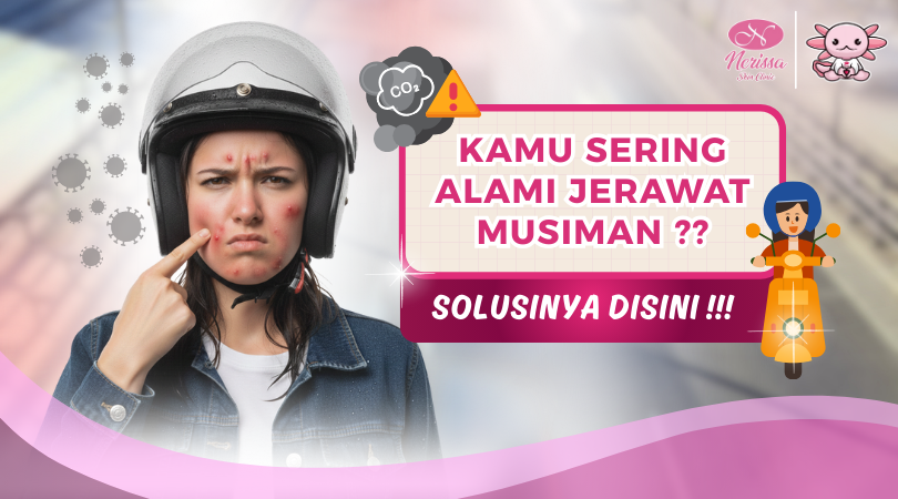 7-solusi-perawatan-wajah-untuk-jerawat-musiman-akibat-hujan-di-nerissa-skin-clinic-purwodadi-grobogan