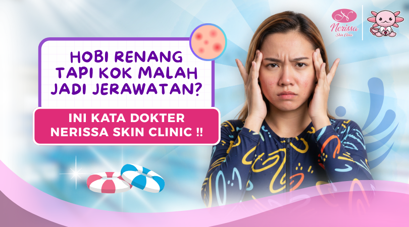 hobi-renang-di-kolam-renang-tapi-kok-jerawatan-solusi-dokter-di-klinik-kecantikan-nerissa-skin-clinic-purwodadi-grobogan