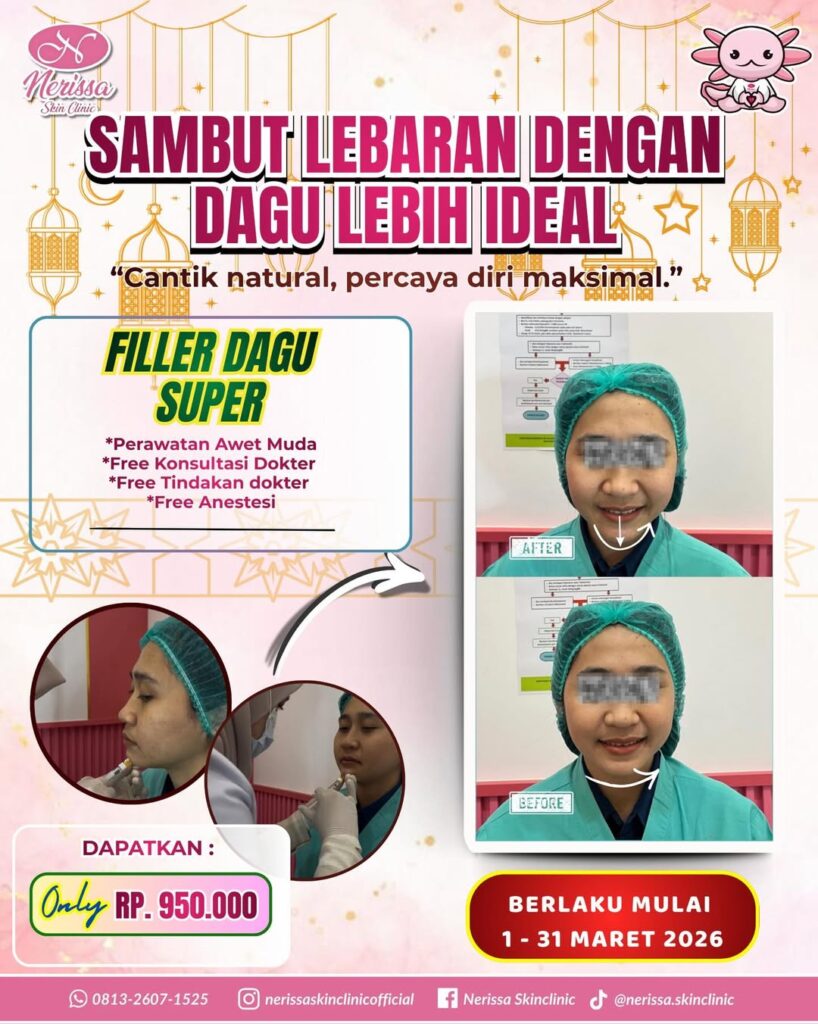 Promo Filler Dagu Super Sambut Lebaran di Nerissa Skin Clinic Purwodadi Grobogan Klinik Kecantikan Terbaik