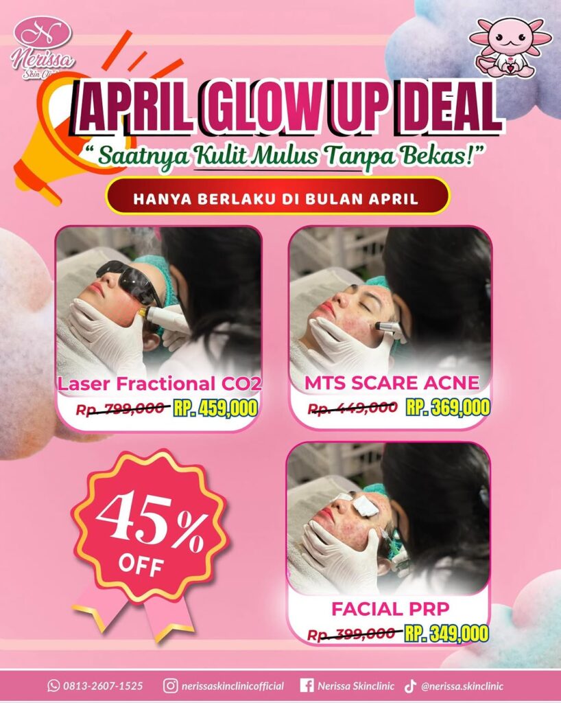 april-glow-up-deal-promo-treatment-perawatan-scar-acne-bopeng-di-nerissa-skin-clinic-purwodadi-grobogan