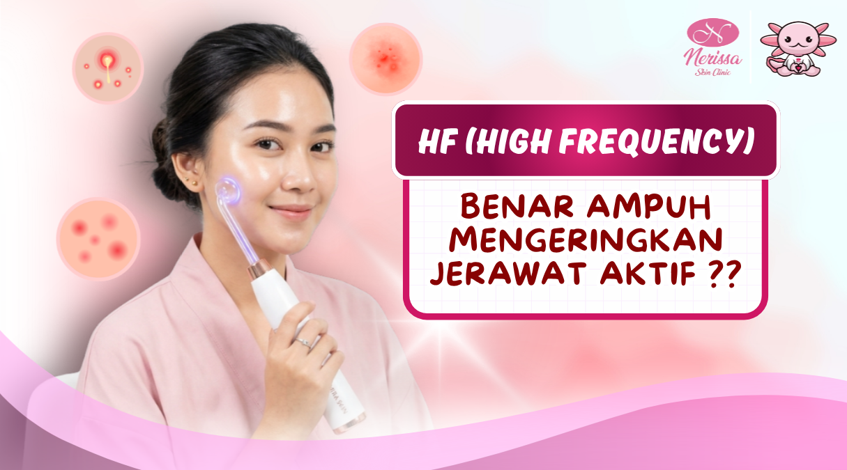 treatment-hf-aurora-wave-therapy-ampuh-mengeringkan-jerawat-aktif-di-nerissa-skin-clinic-purwodadi-grobogan