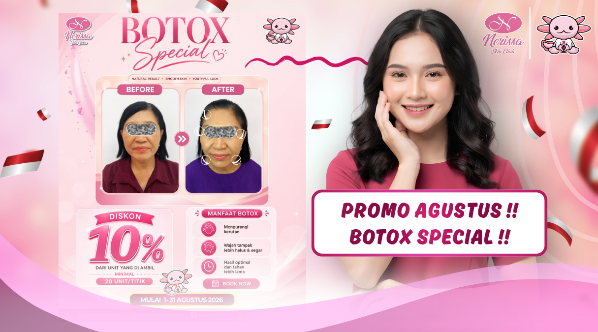 promo-botox-juga-ada-manfaat-medisnya-promo-agustus-klinik kecantikan-terbaik-di-nerissa-skin-clinic-purwodadi-grobogan