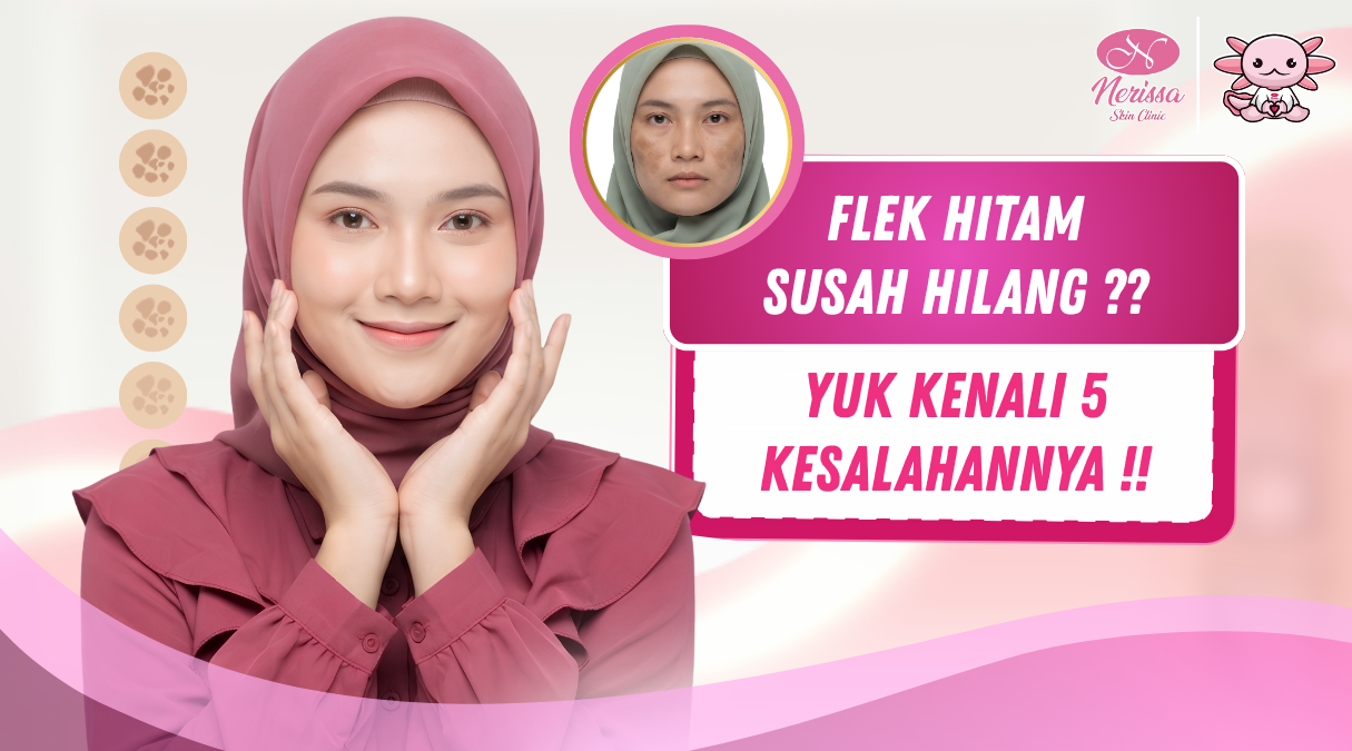 flek-hitam-susah-hilang-yuk-kenali-5-kesalahannya-di-klinik-kecantikan-nerissa-skin-clinic-purwodadi-grobogan