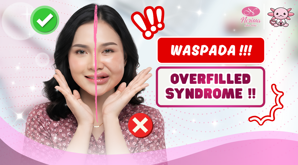 waspada-filler-berlebihan-atau-overfilled-syndrome-di-klinik-kecantikan-nerissa-skin-clinic-purwodadi-grobogan